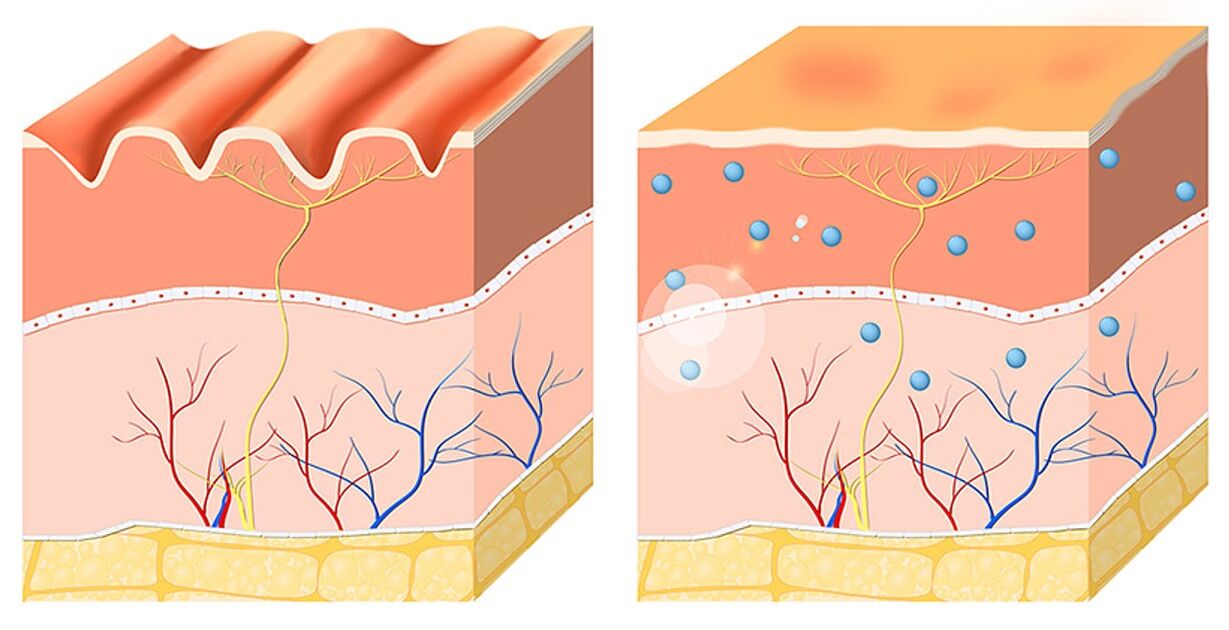 Inno Gialuron suaviza e hidrata la epidermis