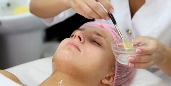Una mujer se somete a un peeling